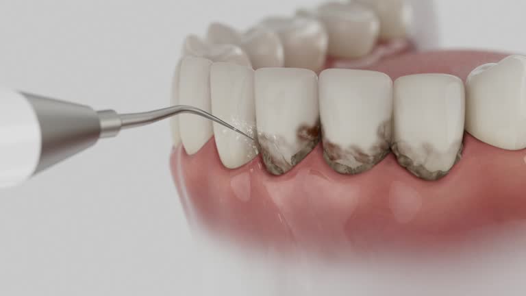 Trusted Invisalign Clear Aligners service in Wolf Trap, VA - Dentist Open Now